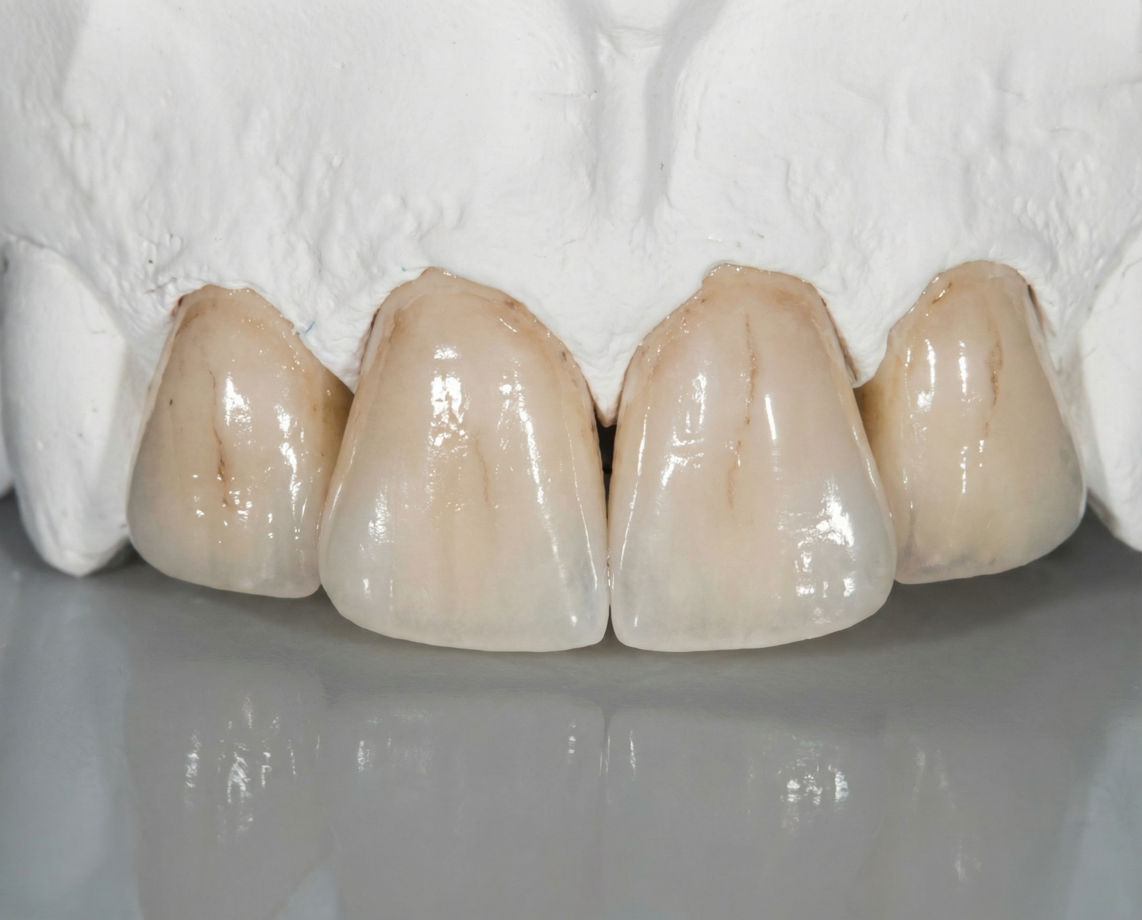 Zircone Multi-Layer